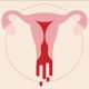 Here Is Why Your Periods Are So Heavy