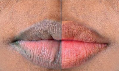5 Natural Ways To Make Your Lips Pink And Soft