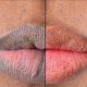 5 Natural Ways To Make Your Lips Pink And Soft
