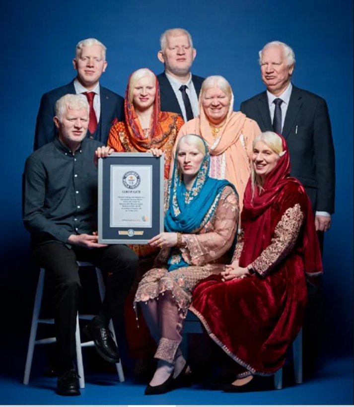 A British family of six brothers and sisters with albinism was awarded a Guinness World Record in the category of most albino siblings.