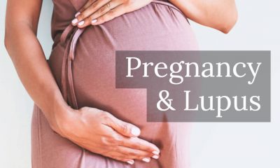 Pregnancy lupus