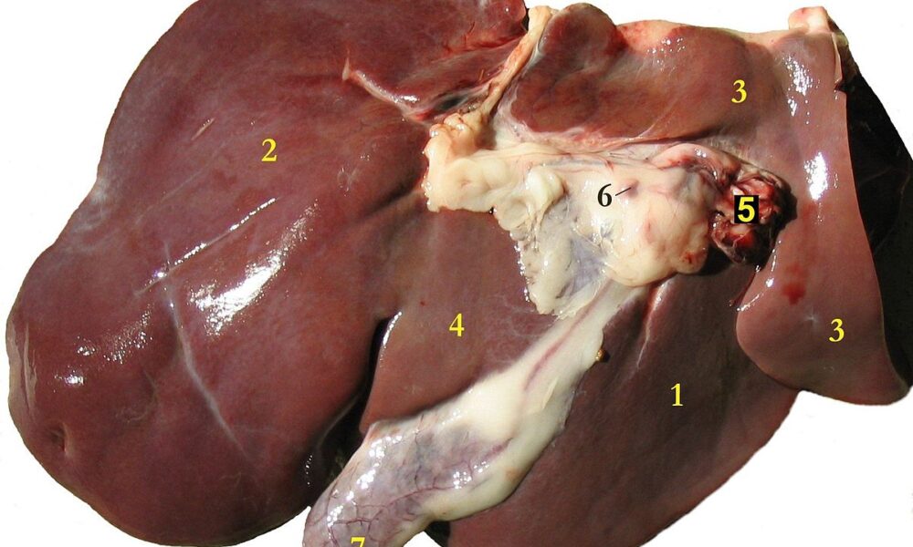 food damage liver