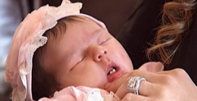 Newborn with complete teeth