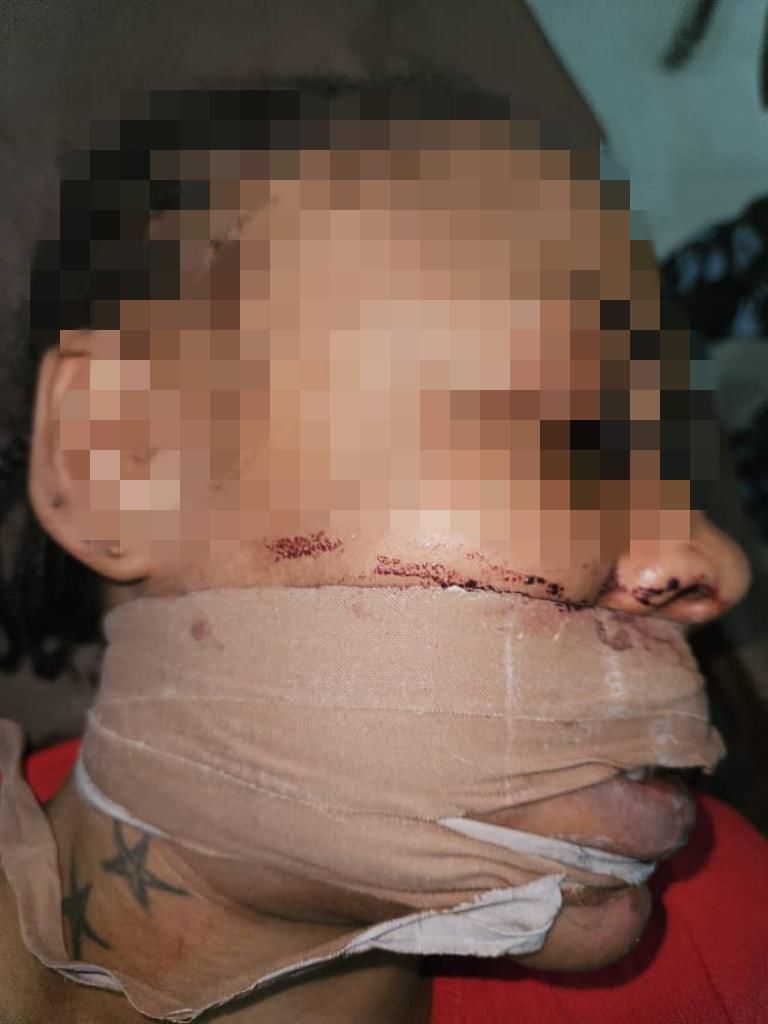 Police Rescue Woman Ritualist Robber